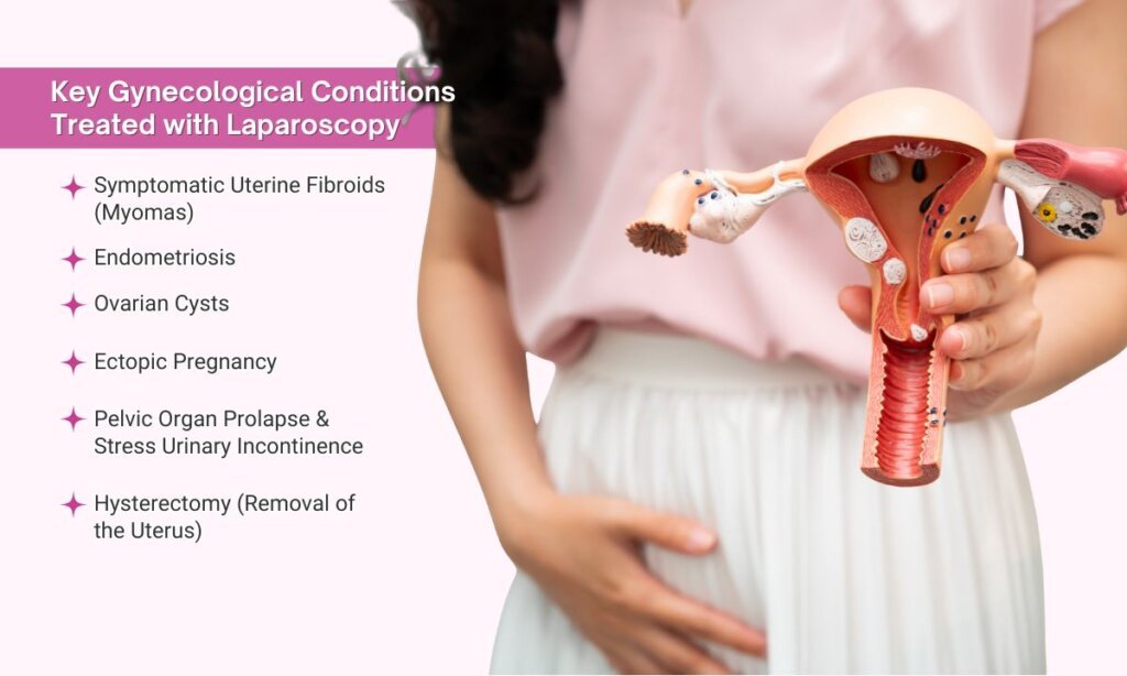 Which Gynecological Problems Require Laparoscopic Surgery? 2 Which Gynecological Problems Require Laparoscopic Surgery